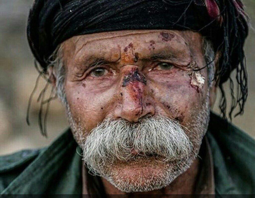 خالو شامار، یکی از زلزله زدگان کرمانشاه به دلیل فقر خودکشی کرد